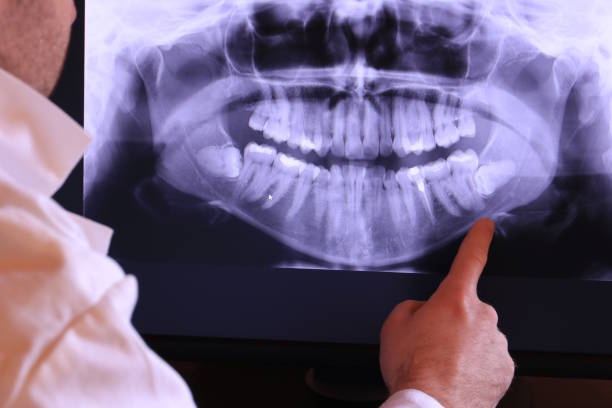 Best Emergency Root Canal Treatment in Toast, NC