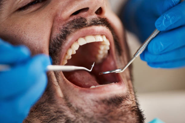Best Cosmetic Emergency Dentistry in Toast, NC